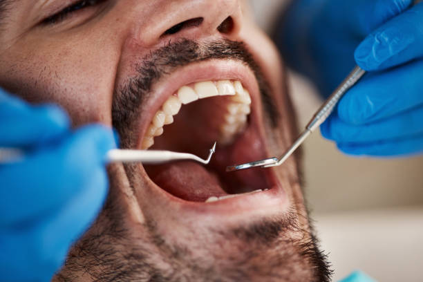 Best Emergency Treatment for Oral Infections in Horace, ND
